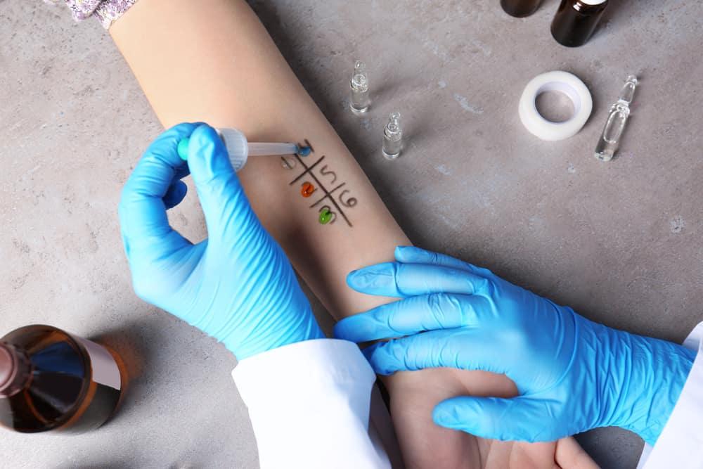 Kapan Alergi Kulit Perlu Pemeriksaan Dokter Panduan Lengkap Memahami Reaksi Kulit Dan Tanda Bahaya